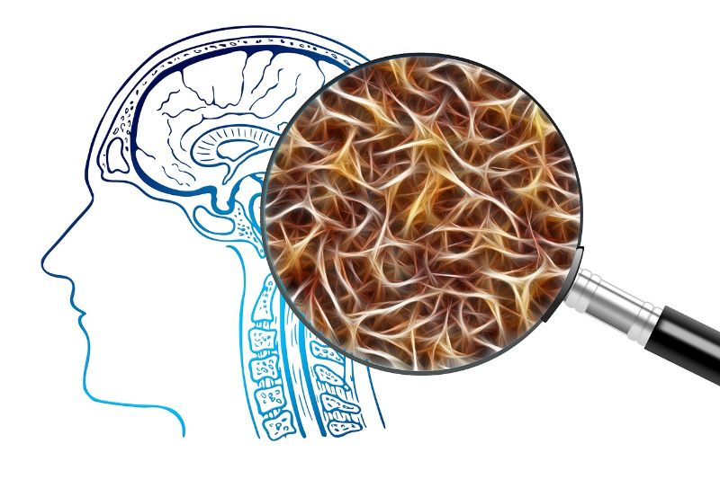 Alzheimer's Disease Alzheimer's Disease
