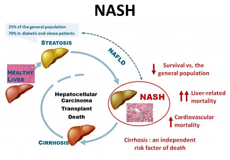 Non-alcoholic fatty liver disease (NAFLD) Non-alcoholic fatty liver disease (NAFLD)