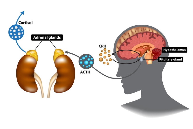 Cushing’s Disease