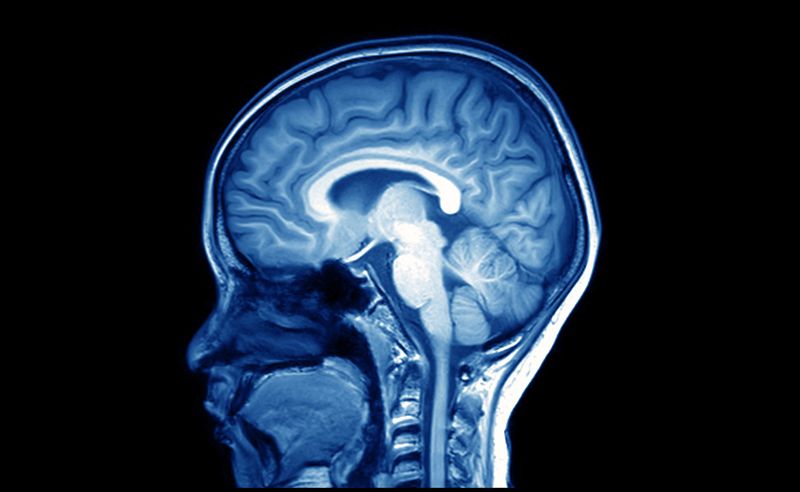 Alzheimer’s Disease Alzheimer’s Disease