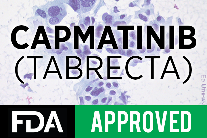 Tabrecta (capmatinib) Tabrecta (capmatinib)