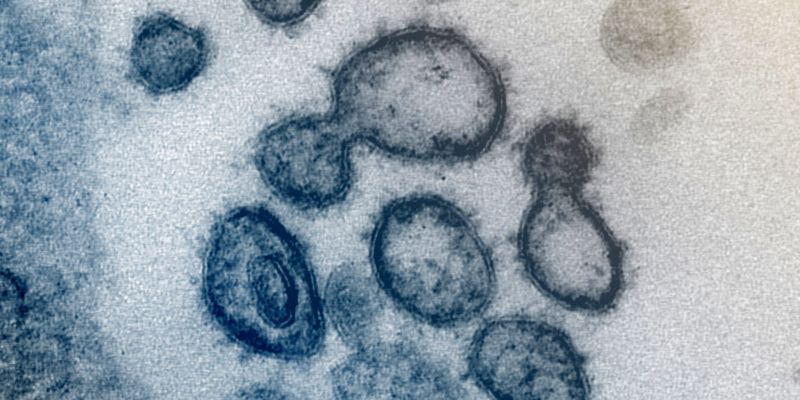 coronavirus-covid-19 coronavirus-covid-19
