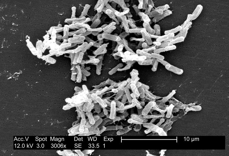 Recurrent Clostridium difficile Infection Recurrent Clostridium difficile Infection