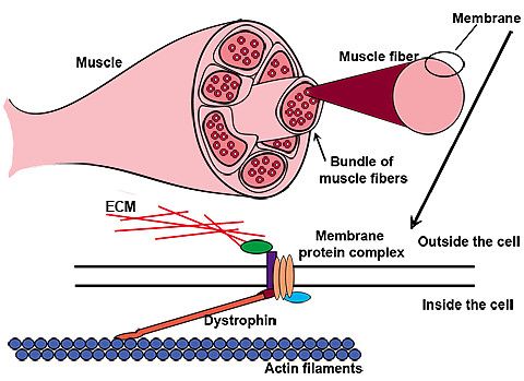 Duchenne Muscular Dystrophy (DMD) Duchenne Muscular Dystrophy (DMD)