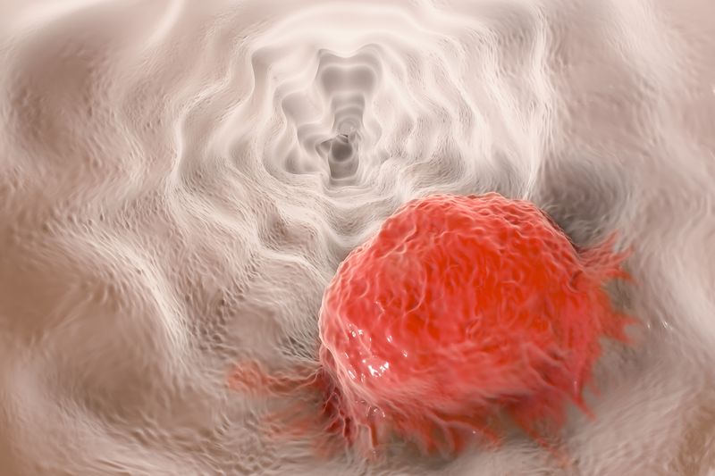 non-endometrial advanced solid cancers non-endometrial advanced solid cancers