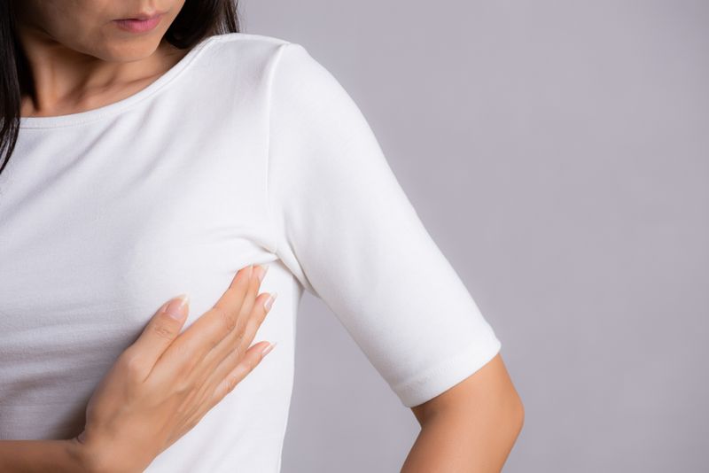 Metastatic Breast Cancer Metastatic Breast Cancer