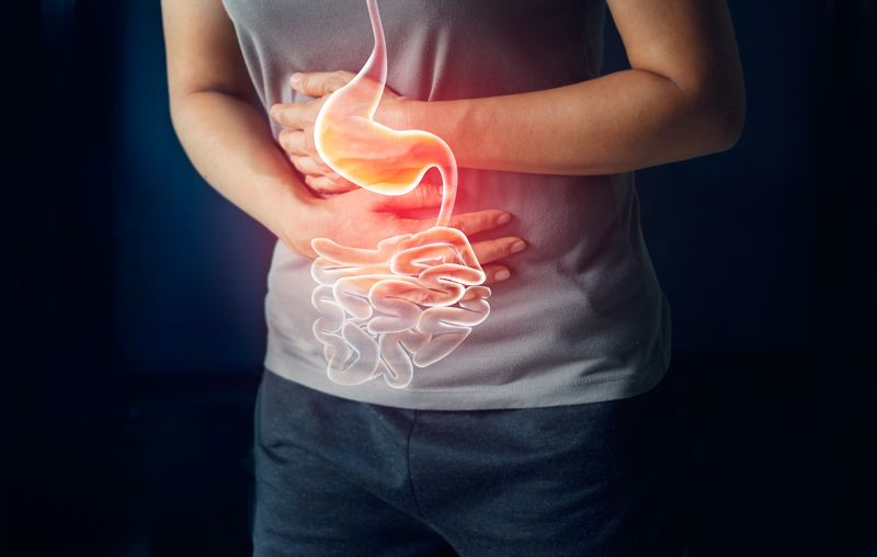 Ulcerative Colitis Ulcerative Colitis