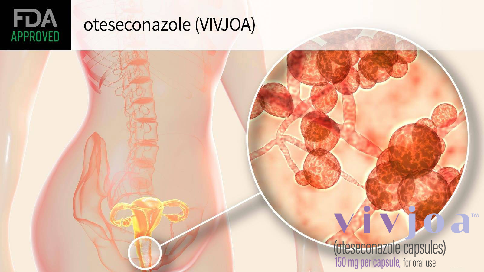Vivjoa (oteseconazole) Vivjoa (oteseconazole)