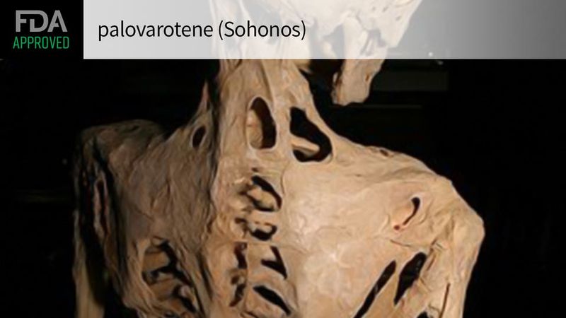 Sohonos (palovarotene) Sohonos (palovarotene)