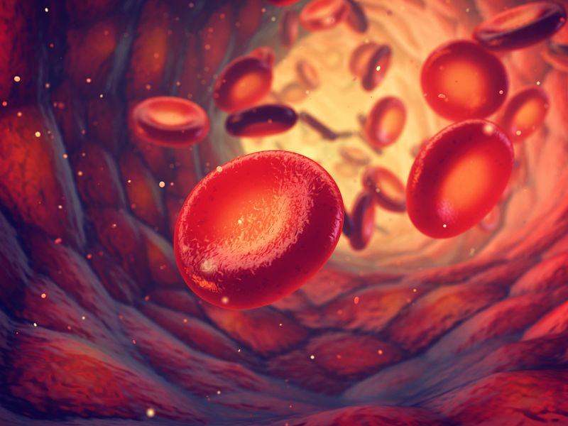 Sickle Cell Disease and a History of Vaso-Occlusive Events Sickle Cell Disease and a History of Vaso-Occlusive Events