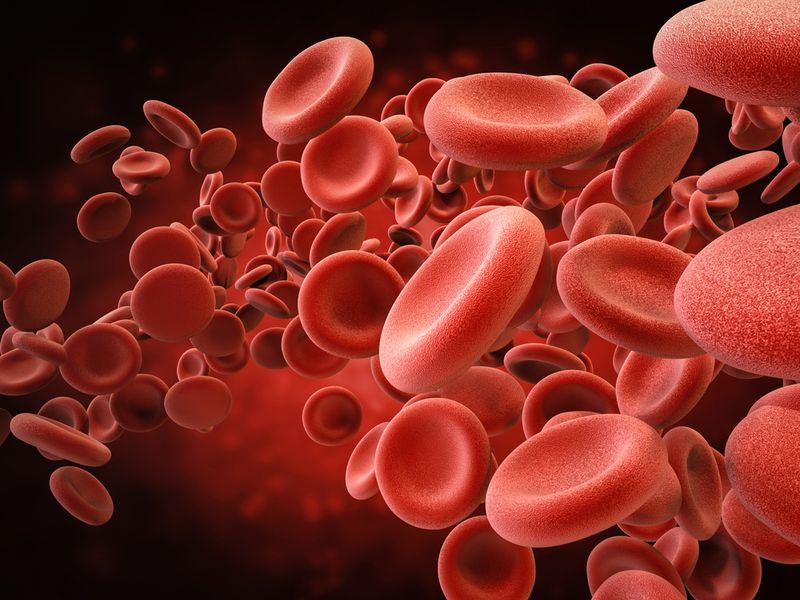 Paroxysmal Nocturnal Hemoglobinuria Paroxysmal Nocturnal Hemoglobinuria