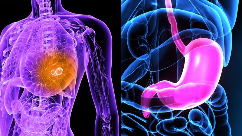 breast and gastric cancers breast and gastric cancers