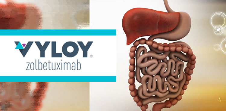 Vyloy (zolbetuximab-clzb) Vyloy (zolbetuximab-clzb)