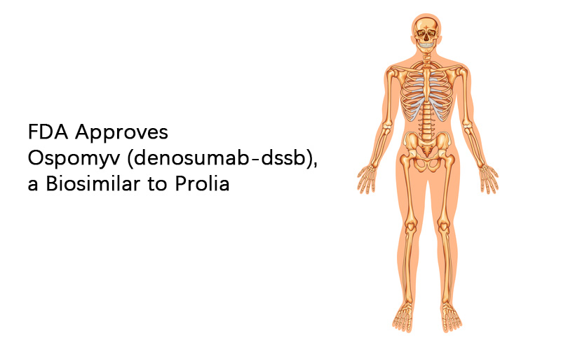 FDA Approves Ospomyv (denosumab-dssb), a Biosimilar to Prolia FDA Approves Ospomyv (denosumab-dssb), a Biosimilar to Prolia