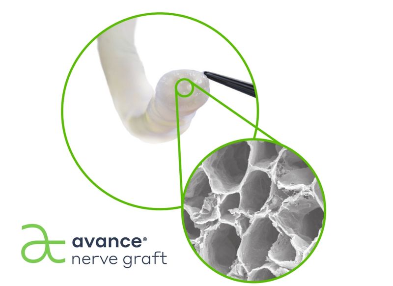 Avance (acellular nerve allograft–arwx) Avance (acellular nerve allograft–arwx)